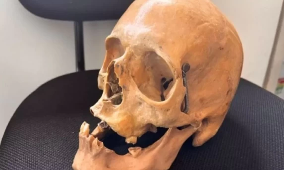 Crânio humano é encontrado em armário de ex-coletor em Santa Helena