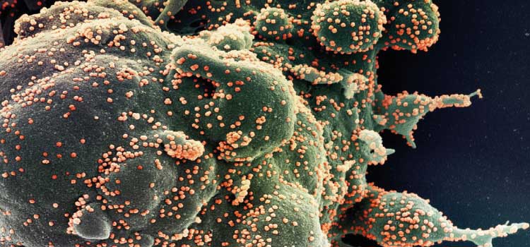 PANDEMIA: Novos casos e mortes por covid-19 continuam a baixar no mundo.